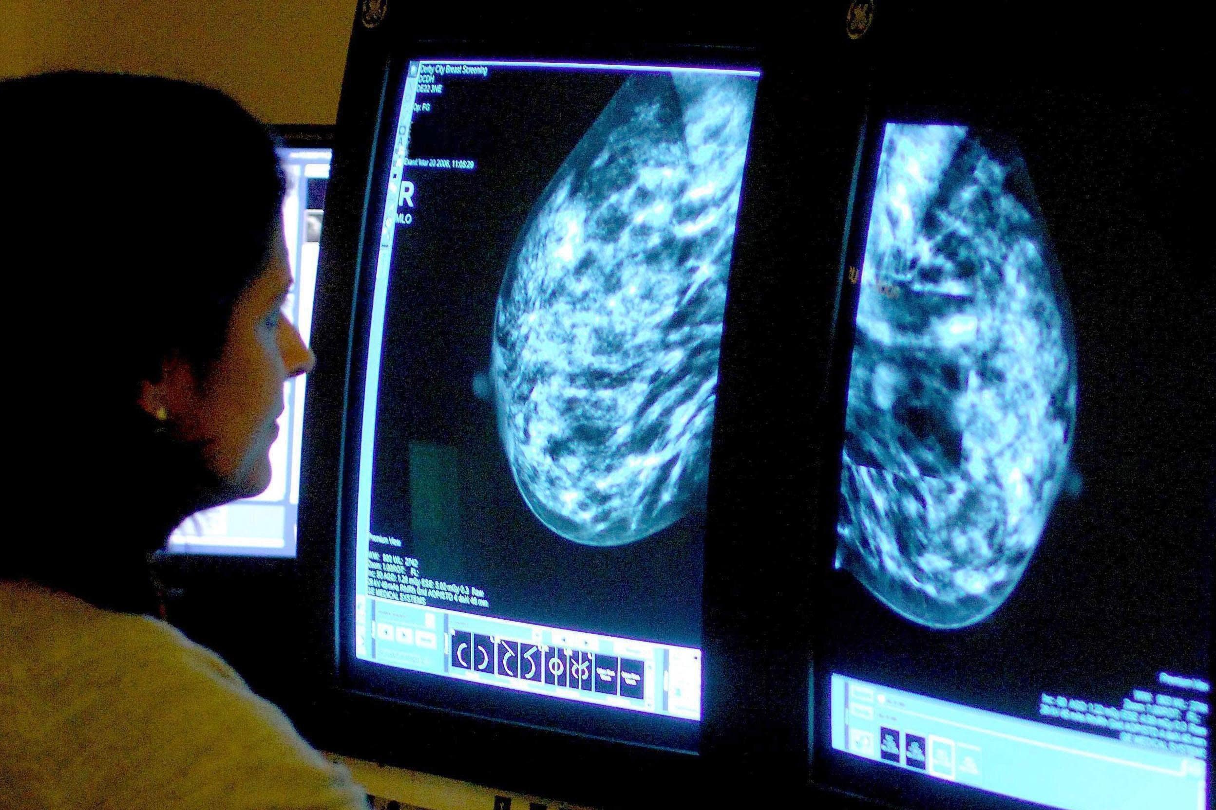 卫生部长正在考虑加强与隆胸相关的癌症警告